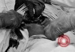 Standbild Die Abdominal- wunde Chirurgie auf Ersten Weltkrieg Soldat Frankreich, 1918, aus Sekunde 30 historischem Filmmaterial Videoclip 65675042421
