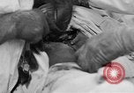 Standbild Die Abdominal- wunde Chirurgie auf Ersten Weltkrieg Soldat Frankreich, 1918, aus Sekunde 31 historischem Filmmaterial Videoclip 65675042421