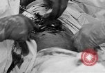 Standbild Die Abdominal- wunde Chirurgie auf Ersten Weltkrieg Soldat Frankreich, 1918, aus Sekunde 32 historischem Filmmaterial Videoclip 65675042421