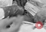 Standbild Die Abdominal- wunde Chirurgie auf Ersten Weltkrieg Soldat Frankreich, 1918, aus Sekunde 34 historischem Filmmaterial Videoclip 65675042421
