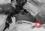 Standbild Die Abdominal- wunde Chirurgie auf Ersten Weltkrieg Soldat Frankreich, 1918, aus Sekunde 35 historischem Filmmaterial Videoclip 65675042421