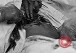 Standbild Die Abdominal- wunde Chirurgie auf Ersten Weltkrieg Soldat Frankreich, 1918, aus Sekunde 36 historischem Filmmaterial Videoclip 65675042421