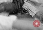 Standbild Die Abdominal- wunde Chirurgie auf Ersten Weltkrieg Soldat Frankreich, 1918, aus Sekunde 37 historischem Filmmaterial Videoclip 65675042421