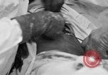 Standbild Die Abdominal- wunde Chirurgie auf Ersten Weltkrieg Soldat Frankreich, 1918, aus Sekunde 38 historischem Filmmaterial Videoclip 65675042421