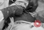 Standbild Die Abdominal- wunde Chirurgie auf Ersten Weltkrieg Soldat Frankreich, 1918, aus Sekunde 39 historischem Filmmaterial Videoclip 65675042421