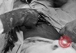 Standbild Die Abdominal- wunde Chirurgie auf Ersten Weltkrieg Soldat Frankreich, 1918, aus Sekunde 40 historischem Filmmaterial Videoclip 65675042421