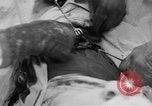Standbild Die Abdominal- wunde Chirurgie auf Ersten Weltkrieg Soldat Frankreich, 1918, aus Sekunde 41 historischem Filmmaterial Videoclip 65675042421