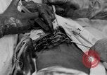 Standbild Die Abdominal- wunde Chirurgie auf Ersten Weltkrieg Soldat Frankreich, 1918, aus Sekunde 45 historischem Filmmaterial Videoclip 65675042421