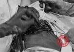 Standbild Die Abdominal- wunde Chirurgie auf Ersten Weltkrieg Soldat Frankreich, 1918, aus Sekunde 50 historischem Filmmaterial Videoclip 65675042421