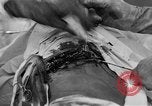 Standbild Die Abdominal- wunde Chirurgie auf Ersten Weltkrieg Soldat Frankreich, 1918, aus Sekunde 54 historischem Filmmaterial Videoclip 65675042421