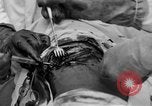 Standbild Die Abdominal- wunde Chirurgie auf Ersten Weltkrieg Soldat Frankreich, 1918, aus Sekunde 56 historischem Filmmaterial Videoclip 65675042421