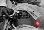 Standbild Die Abdominal- wunde Chirurgie auf Ersten Weltkrieg Soldat Frankreich, 1918, aus Sekunde 58 historischem Filmmaterial Videoclip 65675042421
