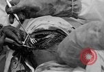 Standbild Die Abdominal- wunde Chirurgie auf Ersten Weltkrieg Soldat Frankreich, 1918, aus Sekunde 60 historischem Filmmaterial Videoclip 65675042421