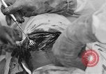 Standbild Die Abdominal- wunde Chirurgie auf Ersten Weltkrieg Soldat Frankreich, 1918, aus Sekunde 62 historischem Filmmaterial Videoclip 65675042421