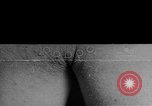 Image of Surgery on Allied soldiers World War 1 France, 1918, second 1 stock footage video 65675042423