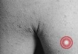 Image of Surgery on Allied soldiers World War 1 France, 1918, second 13 stock footage video 65675042423