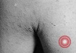 Image of Surgery on Allied soldiers World War 1 France, 1918, second 16 stock footage video 65675042423