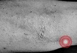 Image of Surgery on Allied soldiers World War 1 France, 1918, second 35 stock footage video 65675042423
