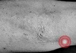 Image of Surgery on Allied soldiers World War 1 France, 1918, second 36 stock footage video 65675042423