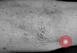 Image of Surgery on Allied soldiers World War 1 France, 1918, second 37 stock footage video 65675042423