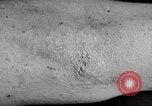 Image of Surgery on Allied soldiers World War 1 France, 1918, second 38 stock footage video 65675042423