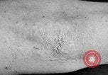 Image of Surgery on Allied soldiers World War 1 France, 1918, second 39 stock footage video 65675042423