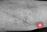 Image of Surgery on Allied soldiers World War 1 France, 1918, second 40 stock footage video 65675042423