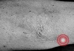 Image of Surgery on Allied soldiers World War 1 France, 1918, second 41 stock footage video 65675042423