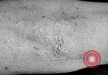 Image of Surgery on Allied soldiers World War 1 France, 1918, second 42 stock footage video 65675042423