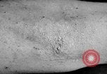 Image of Surgery on Allied soldiers World War 1 France, 1918, second 43 stock footage video 65675042423