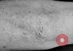 Image of Surgery on Allied soldiers World War 1 France, 1918, second 44 stock footage video 65675042423