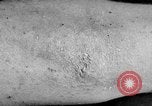 Image of Surgery on Allied soldiers World War 1 France, 1918, second 45 stock footage video 65675042423
