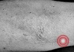 Image of Surgery on Allied soldiers World War 1 France, 1918, second 47 stock footage video 65675042423