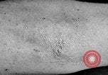 Image of Surgery on Allied soldiers World War 1 France, 1918, second 48 stock footage video 65675042423
