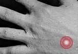 Image of Surgery on Allied soldiers World War 1 France, 1918, second 51 stock footage video 65675042423