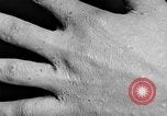 Image of Surgery on Allied soldiers World War 1 France, 1918, second 52 stock footage video 65675042423