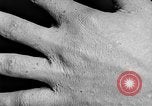 Image of Surgery on Allied soldiers World War 1 France, 1918, second 53 stock footage video 65675042423
