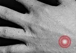 Image of Surgery on Allied soldiers World War 1 France, 1918, second 54 stock footage video 65675042423