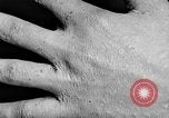 Image of Surgery on Allied soldiers World War 1 France, 1918, second 55 stock footage video 65675042423