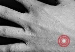 Image of Surgery on Allied soldiers World War 1 France, 1918, second 56 stock footage video 65675042423