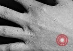 Image of Surgery on Allied soldiers World War 1 France, 1918, second 57 stock footage video 65675042423