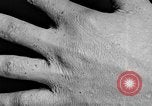Image of Surgery on Allied soldiers World War 1 France, 1918, second 60 stock footage video 65675042423