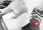 Image of leg surgery on wounded soldier France, 1918, second 1 stock footage video 65675042425