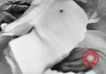 Image of leg surgery on wounded soldier France, 1918, second 4 stock footage video 65675042425