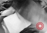 Image of leg surgery on wounded soldier France, 1918, second 5 stock footage video 65675042425