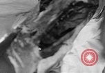 Image of leg surgery on wounded soldier France, 1918, second 9 stock footage video 65675042425