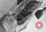 Image of leg surgery on wounded soldier France, 1918, second 10 stock footage video 65675042425