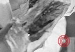 Image of leg surgery on wounded soldier France, 1918, second 11 stock footage video 65675042425
