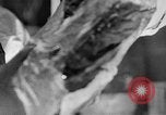 Image of leg surgery on wounded soldier France, 1918, second 12 stock footage video 65675042425