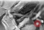 Image of leg surgery on wounded soldier France, 1918, second 13 stock footage video 65675042425